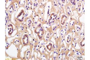 Formalin-fixed and paraffin embedded human kidney labeled with Rabbit Anti Phospho-Beta Catenin (Thr41/Ser45) Polyclonal Antibody, Unconjugated (ABIN683953) at 1:200 followed by conjugation to the secondary antibody and DAB staining (beta Catenin 抗体  (pSer45, pThr41))