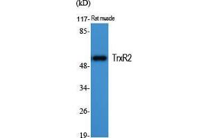Western Blot (WB) analysis of specific cells using TrxR2 Polyclonal Antibody. (TXNRD2 抗体  (C-Term))