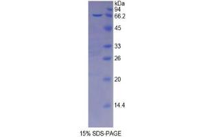 SDS-PAGE analysis of Mouse Protease, Serine 8 Protein. (Protease 蛋白)