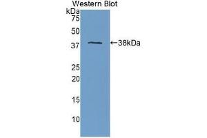 Detection of Recombinant APOH, Human using Polyclonal Antibody to Apolipoprotein H (APOH) (APOH 抗体  (AA 22-345))