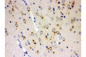 IHC testing of FFPE rat brain with SSH3BP1 antibody. (ABI1 抗体)