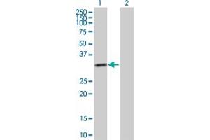 Western Blot analysis of KHK expression in transfected 293T cell line by KHK MaxPab polyclonal antibody. (Ketohexokinase 抗体  (AA 1-298))