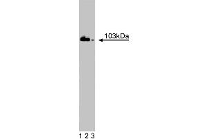 Western blot analysis of DNA Ligase III on Jurkat cell lysate.