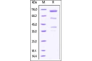 SDS-PAGE (SDS) image for Glypican 3 (GPC3) (AA 25-559) (Active) protein (Fc Tag) (ABIN4949055)