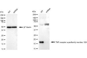 Western blotting analysis using TNF receptor superfamily member 12A antibody (ABIN7800674).
