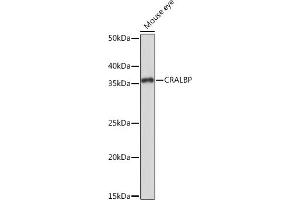 Western blot analysis of extracts of Mouse eye, using CRALBP Rabbit mAb (ABIN7269934) at 1:1000 dilution. (RLBP1 抗体)