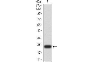 Western blot analysis using UCP3 mAb against human UCP3 (AA: 1-113 and 217-312) recombinant protein. (UCP3 抗体  (AA 1-113, AA 217-312))