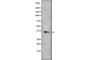 Western blot analysis OR52N5 using 293 whole cell lysates (OR52N5 抗体  (C-Term))