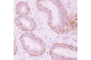 Anti-CTNNA1 Picoband antibody,  IHC(P): Human Mammary Tissue (CTNNA1 抗体  (AA 143-292))
