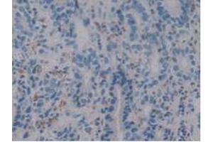 IHC-P analysis of Human Stomach Tissue, with DAB staining. (Iba1 抗体  (AA 1-147))