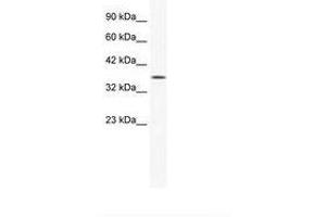 Image no. 2 for anti-Y Box Binding Protein 2 (YBX2) (AA 178-227) antibody (ABIN202349) (YBX2 抗体  (AA 178-227))
