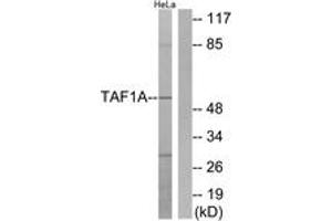 Western blot analysis of extracts from HeLa cells, using TAF1A Antibody. (TAF1A 抗体  (AA 301-350))