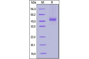 Fed Human IL-13 R alpha 2, His Tag on  under reducing (R) condition. (IL13RA2 Protein (AA 27-343) (FITC,His tag))