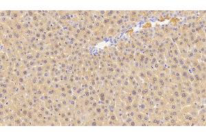 Detection of CGRP in Mouse Liver Tissue using Polyclonal Antibody to Calcitonin Gene Related Peptide (CGRP) (CGRP 抗体  (AA 1-130))