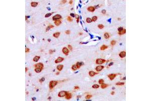 Immunohistochemical analysis of IPPK staining in human brain formalin fixed paraffin embedded tissue section. (IPPK 抗体  (N-Term))
