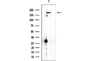 Western blot analysis of lysates from EC304 cells, using PDGF Receptor beta Mouse Monoclonal Antibody at 1/1000 dilution.