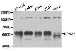 Western blot analysis of extracts of various cell lines, using KPNA3 antibody. (KPNA3 抗体  (AA 1-210))