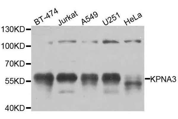 KPNA3 抗体  (AA 1-210)