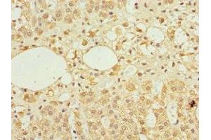 Immunohistochemistry of paraffin-embedded human adrenal gland tissue using ABIN7143883 at dilution of 1:100 (TFCP2 抗体  (AA 1-280))