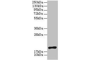 Western blot All lanes: NR2C2AP antibody at 4 μg/mL + HL60 whole cell lysate Secondary Goat polyclonal to rabbit IgG at 1/10000 dilution Predicted band size: 16, 20 kDa Observed band size: 20 kDa (NR2C2AP 抗体  (AA 7-139))