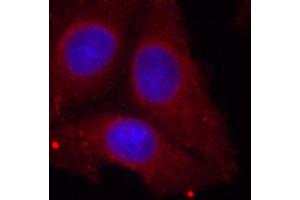 Immunofluorescence (IF) image for anti-Growth Associated Protein 43 (GAP43) (pSer41) antibody (ABIN1870201)