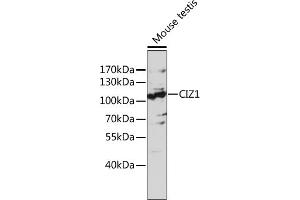 Western blot analysis of extracts of mouse testis, using CIZ1 antibody (ABIN7266237) at 1:1000 dilution. (CIZ1 抗体  (AA 250-440))