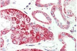 Human, Kidney: Formalin-Fixed Paraffin-Embedded (FFPE) (HADH 抗体  (C-Term))
