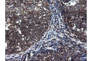 Image no. 3 for anti-CCR4-NOT Transcription Complex Subunit 4 (CNOT4) (AA 190-455) antibody (ABIN1491098)