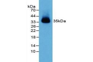 Detection of NECTIN2 in Mouse Heart Tissue using Polyclonal Antibody to Nectin 2 (NECTIN2) (PVRL2 抗体  (AA 83-291))