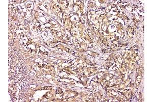 IHC analysis of CA2 using anti-CA2 antibody (ABIN6719533). (CA2 抗体  (AA 2-260))