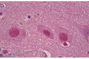 Anti-ROR Alpha antibody IHC staining of human brain, cortex. (RORA 抗体  (AA 6-55))