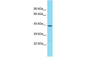 Western Blotting (WB) image for anti-Protein tyrosine Phosphatase, Non-Receptor Type 7 (PTPN7) (Middle Region) antibody (ABIN2788972) (PTPN7 抗体  (Middle Region))