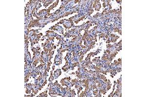 IHC analysis of TOMM34 using anti-TOMM34 antibody (ABIN7599253).