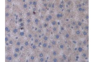 Immunohistochemistry (IHC) image for anti-Signal Transducing Adaptor Molecule (SH3 Domain and ITAM Motif) 1 (STAM) (AA 199-466) antibody (ABIN7443425)