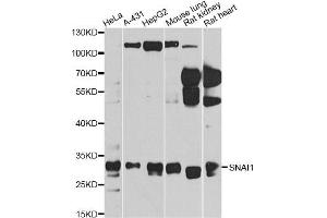 Western blot analysis of extracts of various cell lines, using SNAI1 antibody (ABIN5975364) at 1/1000 dilution. (SNAIL 抗体)