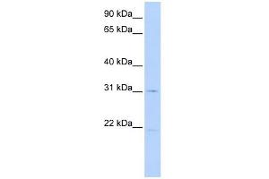 SLC25A21 antibody used at 1 ug/ml to detect target protein. (SLC25A21 抗体)