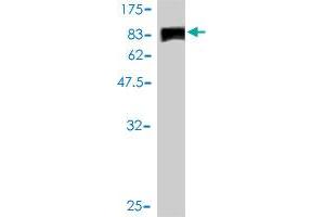Western Blot detection against Immunogen (107. (JUP 抗体  (AA 1-745))