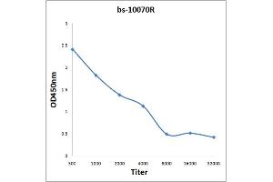 Antigen: 2 µg/100 µL  Primary: Antiserum, 1:500, 1:1000, 1:2000, 1:4000, 1:8000, 1:16000, 1:32000;  Secondary: HRP conjugated Rabbit Anti-Goat IgG at 1: 5000;  TMB staining Read the data in Microplate Reader by 450nm. (IL-31 抗体  (AA 21-120))