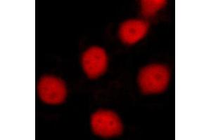 ABIN6269055 staining MCF-7 cells by ICC/IF. (Survivin 抗体  (Internal Region))