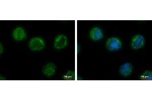 ICC/IF Image CHMP5 antibody [N1C3] detects CHMP5 protein at cytoplasm by immunofluorescent analysis. (CHMP5 抗体)