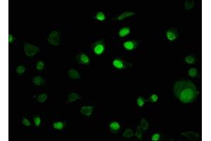 Immunofluorescence staining of MCF-7 cells with ABIN7157075 at 1:100, counter-stained with DAPI. (IRX4 抗体  (AA 287-363))