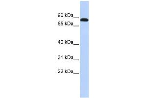 WB Suggested Anti-DSC3 Antibody Titration:  0. (Desmocollin 3 抗体  (N-Term))