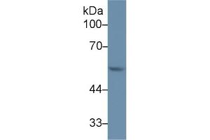 Detection of MMP12 in Rat Thymus lysate using Polyclonal Antibody to Matrix Metalloproteinase 12 (MMP12)