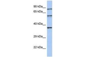 Image no. 1 for anti-Rabphilin 3A (RPH3A) (AA 35-84) antibody (ABIN6744373) (RPH3A 抗体  (AA 35-84))