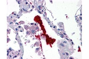 Immunohistochemistry (IHC) image for anti-Kallikrein 6 (KLK6) (N-Term) antibody (ABIN2778179) (Kallikrein 6 抗体  (N-Term))