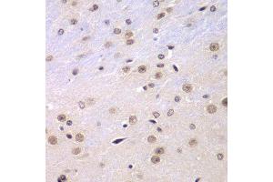 Immunohistochemistry (Paraffin-embedded Sections) (IHC (p)) image for anti-Ring Finger Protein 2 (RNF2) (AA 1-336) antibody (ABIN6147029)