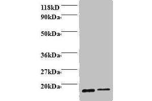 Western blot All lanes: Profilin-1 antibody at 2 μg/mL Lane 1: EC109 whole cell lysate Lane 2: 293T whole cell lysate Secondary Goat polyclonal to rabbit IgG at 1/15000 dilution Predicted band size: 16 kDa Observed band size: 16 kDa