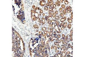 IHC analysis of ECE1 using anti-ECE1 antibody (ABIN5518828). (ECE1 抗体  (AA 18-233))
