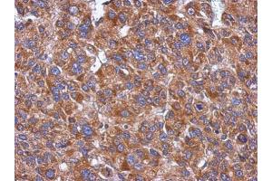 Immunohistochemistry (IHC) image for anti-Cytochrome P450, Family 26, Subfamily A, Polypeptide 1 (CYP26A1) (Center) antibody (ABIN2856004)