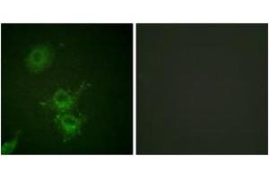 Immunofluorescence analysis of HuvEc cells, using EGFR (Phospho-Thr693) Antibody. (EGFR 抗体  (pThr693))